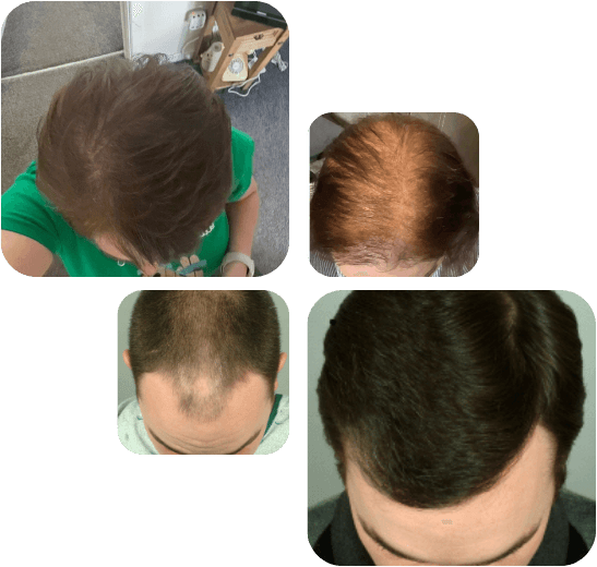 Transformation